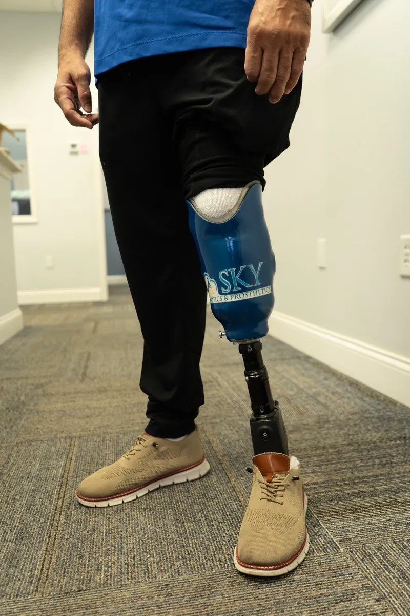 Sky O&P clinician helping patient with prosthetic fitting and adjustment