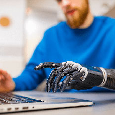 Upper Extremity Prosthetics